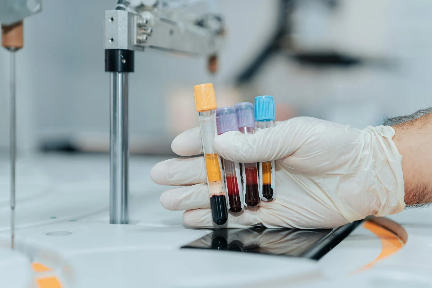 A gloved hand holding four blood collection tubes with different colored caps, the type used for hantavirus serology and PCR.